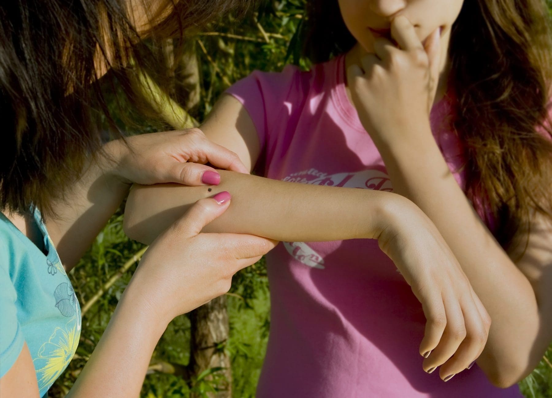 Woman examining forearm of young woman with tick on it. 