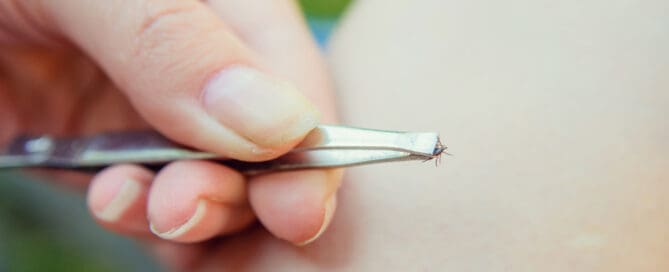 Person holding a tick with metal tweezers