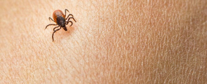 Small tick attached to skin.