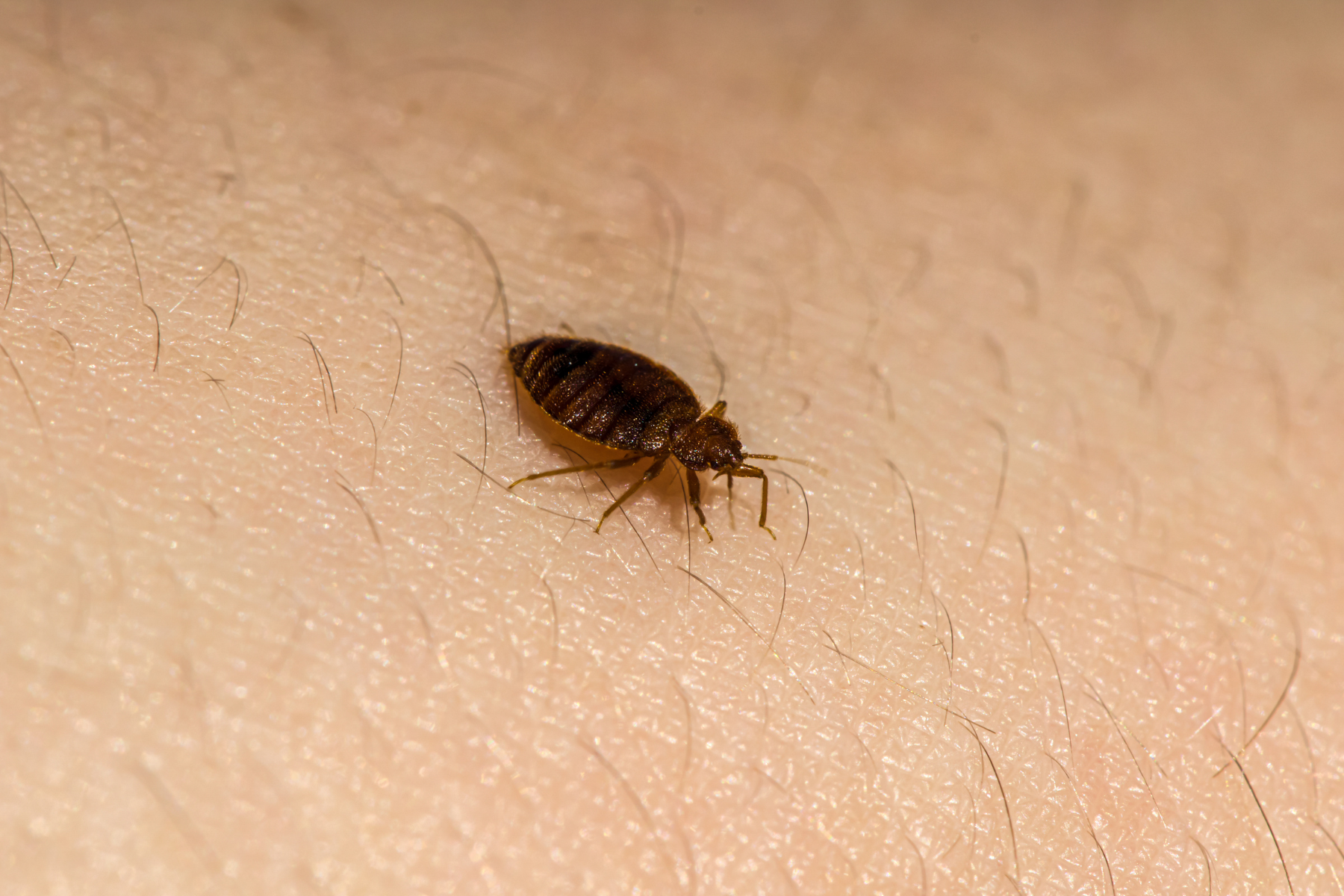 Close up of bed bugs on skin.
