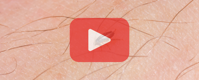 Flea on skin. Red play button overlay and Prevent Pest Control logo.