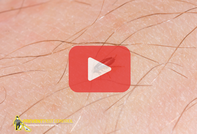 Close up of flea on skin. Red play buttom overlay and PPC logo.